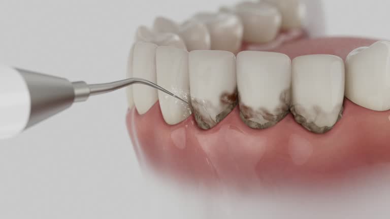 Trusted Teeth Cleaning And Checkup service in Allendale, NJ - Dentist Open Now